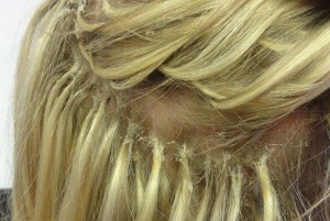 What is traction alopecia, treatment, causes, and symptoms Alopecia and hair extensions