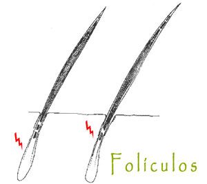 Do you know the types of hair loss or why it falls out? Hair follicles